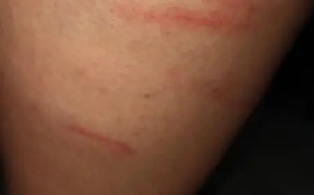 Greater Noida News : चौथी कक्षा के छात्र की बेरहमी से पिटाई