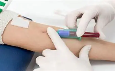 Noida News : खून के एक सैंपल से होगी आठ तरह के वायरस की जांच