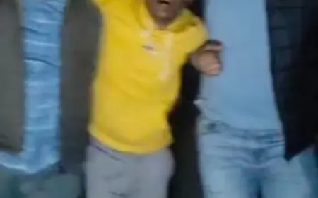 Noida News : पुलिस मुठभेड़ में घायल बदमाश  जिला अस्पताल से  हुआ फरार